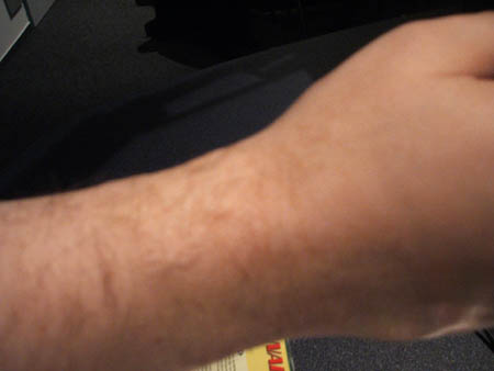 ..aber er ist grausig entstellt!!