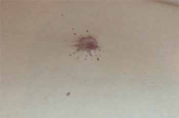 achduschreck, ein rotweinfleck!